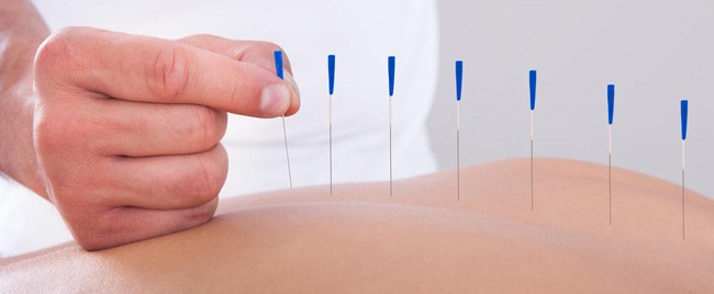 Needling Technique