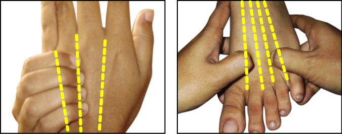 Acupressure point, point of the Nervous system