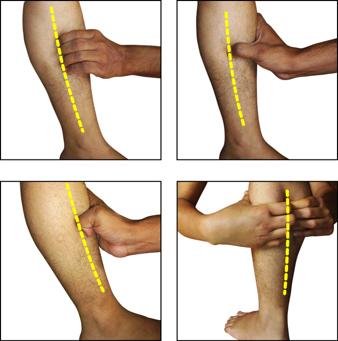 Acupressure point, Points of the Sciatic nerves