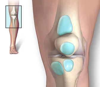 knee bursitis